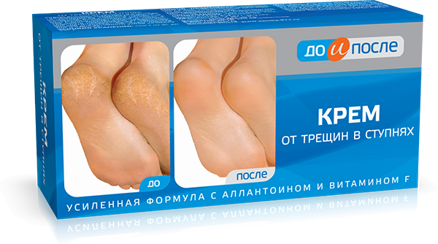 Krém na päty a chodidlá 150 ml